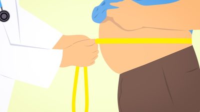 liposution