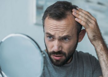 perte-cheveux-homme-front