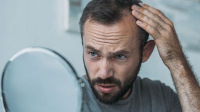 perte-cheveux-homme-front