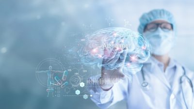 concept-diagnostic-alzheimer